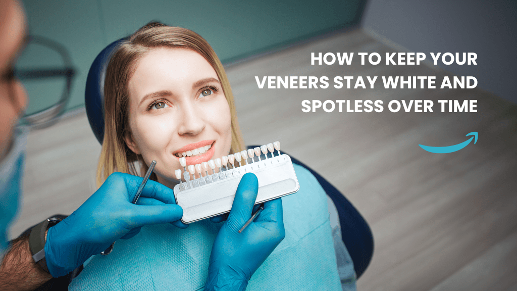 How to Keep Your Veneers Stay White and Spotless Over Time How to Keep Your Veneers Stay White and Spotless Over Time
